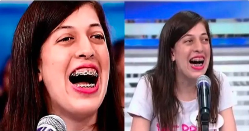 Lembra da Ana Risadinha? Atualmente ela não usa mais aparelho e está irreconhecível