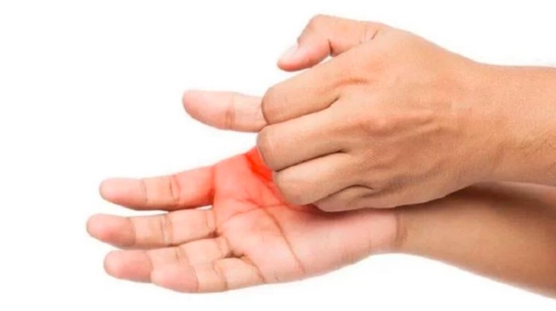 Coceira na palma da mão: Você sabe o que significa? Cuidado, pode ser algo grave