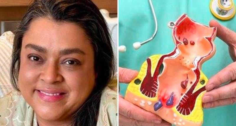 Câncer no Ânus Raro Pode Aparecer Na Vida de Mulheres Que Praticam Se…Ver mais