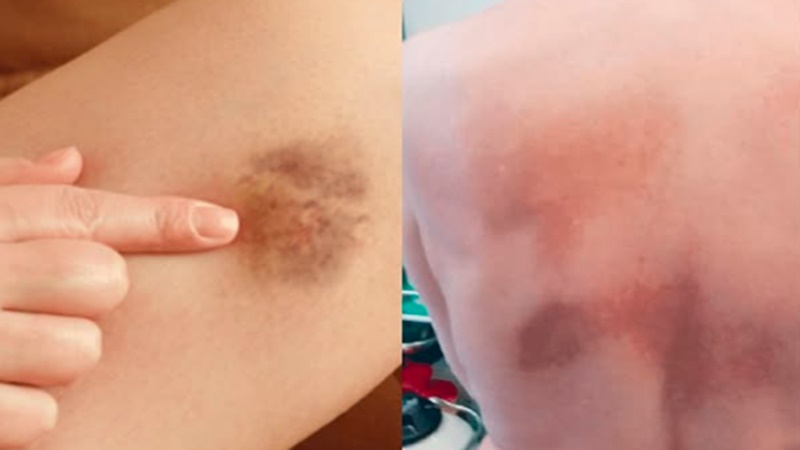 Se essa mancha aqui apareceu na sua pele, significa que você tem c… Ver mais