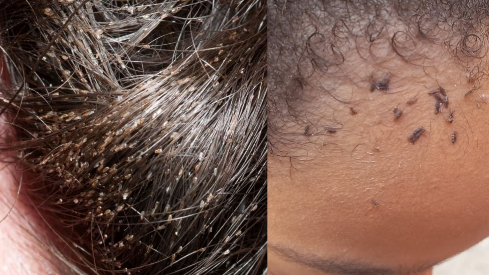 Menina CHORAVA de dor de cabeça e o MOTIVO fez a mãe ligar para a polícia IMEDIATAMENTE: “Tinha… Ver mais