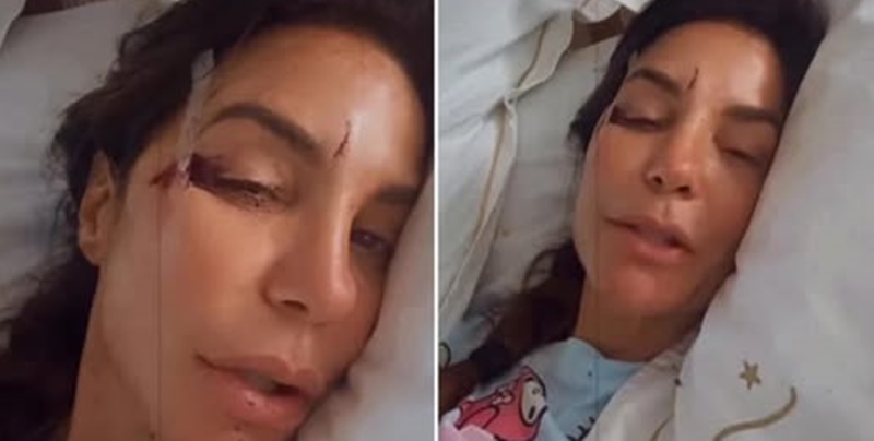 Urgente: Médico afirma que Ivete foi…ver mais