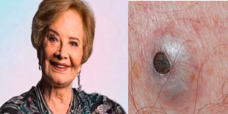 Motivo do óbito de Glória Menezes é chocan…ver mais
