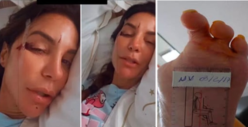 Urgente: Ivete Sangalo é internada e acaba de perder uma per…ver mais
